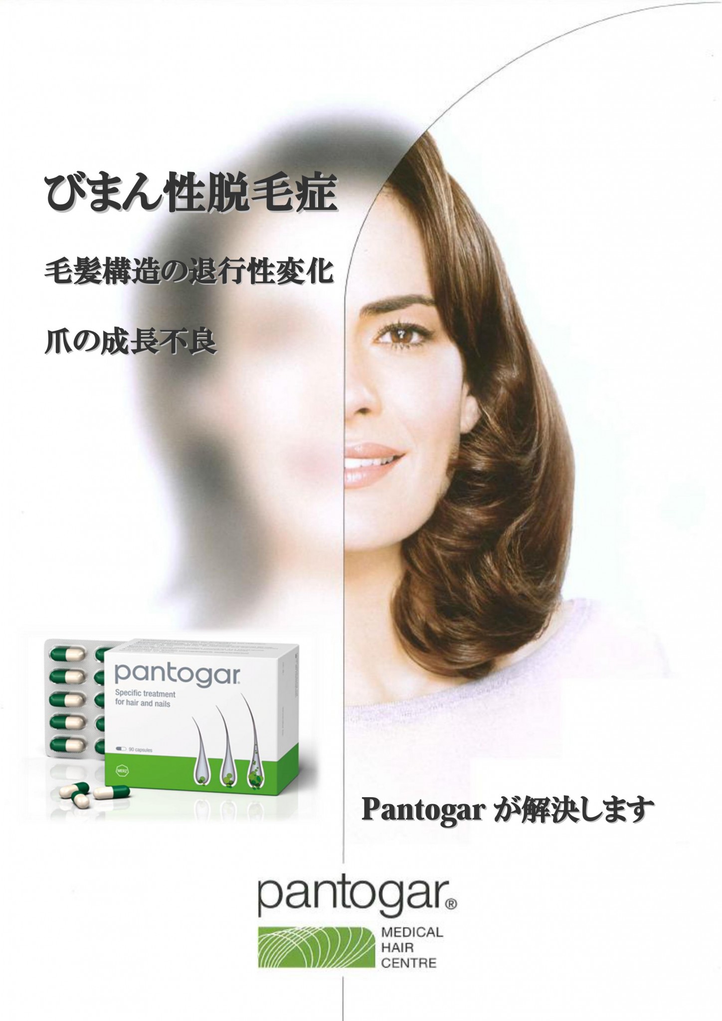 女性の抜け毛・薄毛 治療薬-パントガール(Pantogar)・リポゲイン
